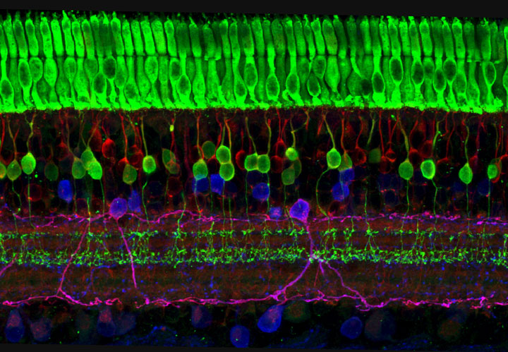 Nerve Cells of Eye's Retina