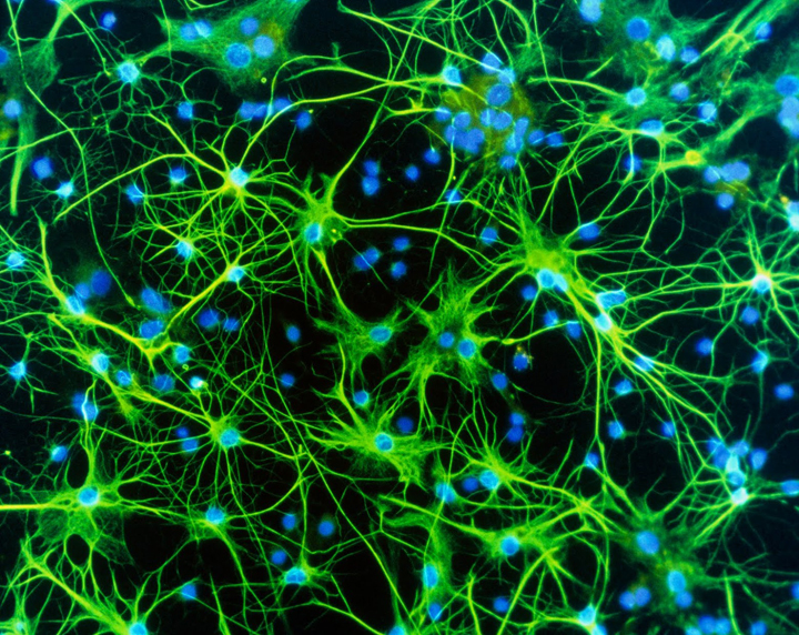 astrocyte brain cells